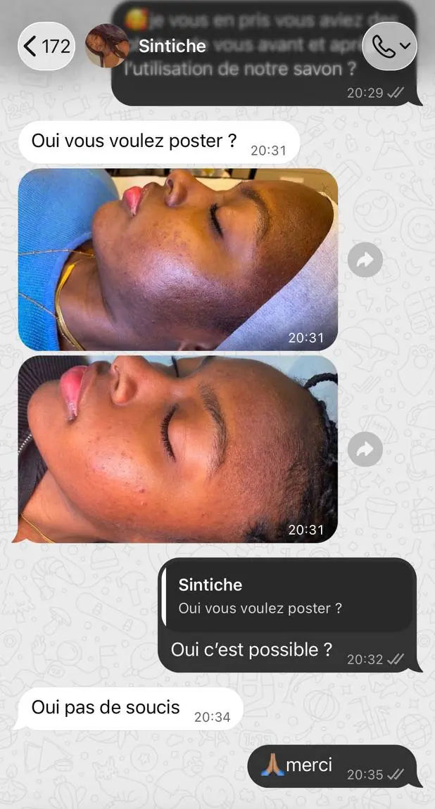 Conversation WhatsApp : une cliente envoie deux photos de son visage et autorise la boutique à les publier.