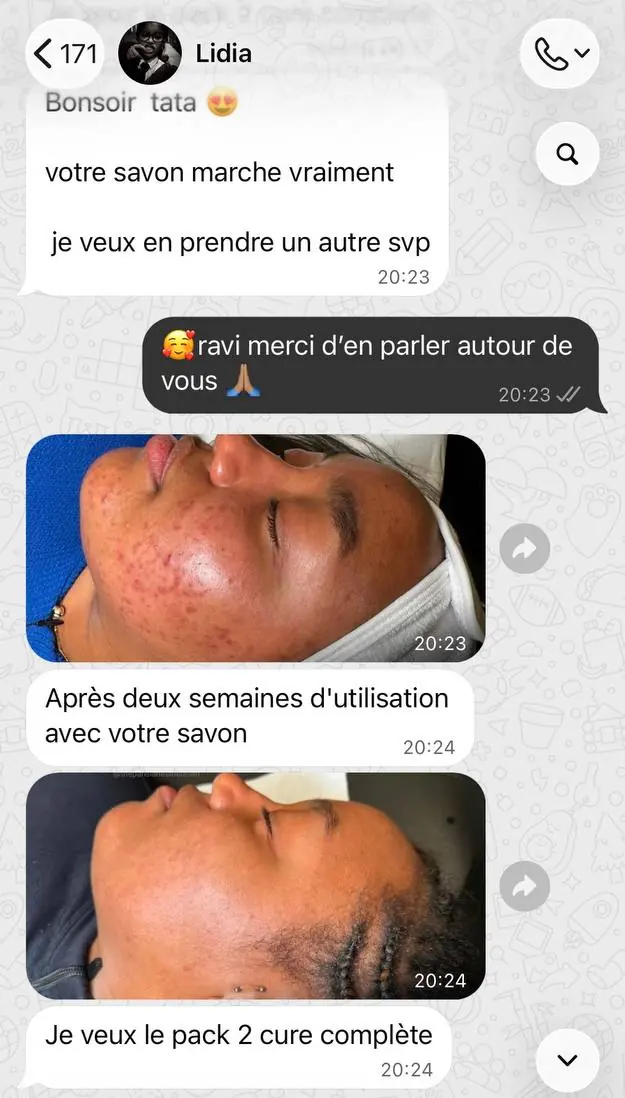 Conversation WhatsApp : une cliente écrit que le savon marche vraiment, envoie deux photos après deux semaines d'utilisation et recommande un pack.