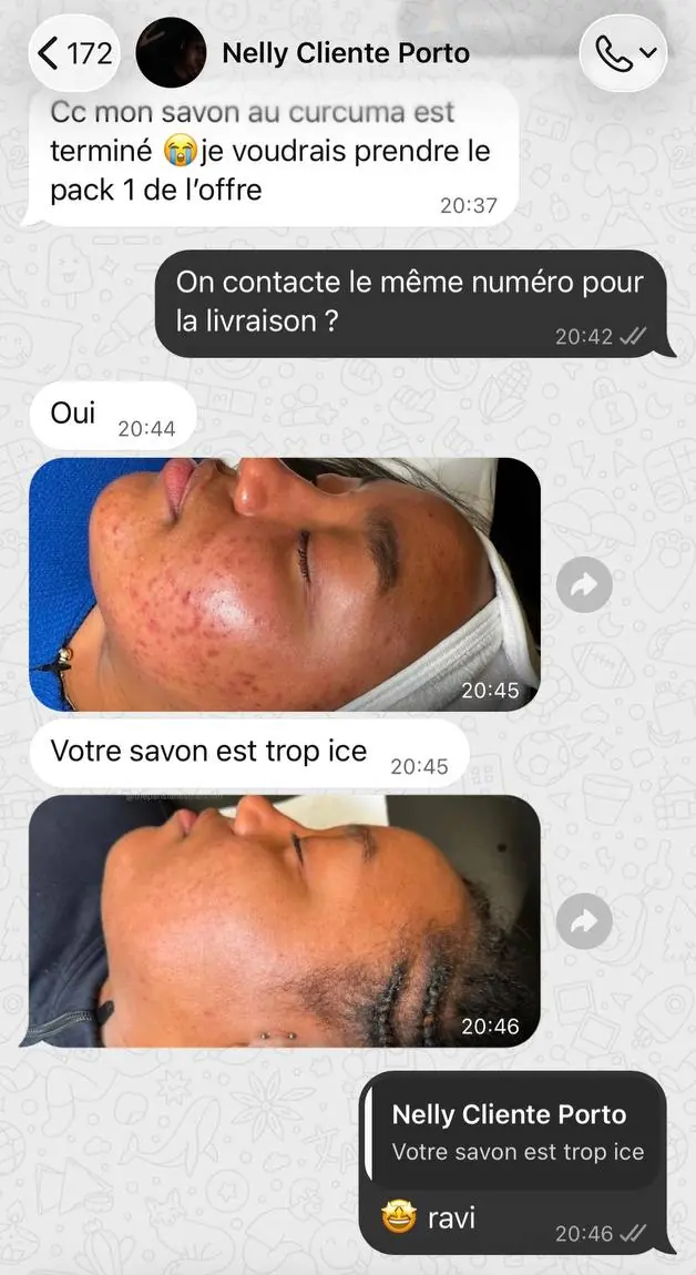 Conversation WhatsApp : une cliente a terminé son savon, en recommande un autre et envoie deux photos de son visage.